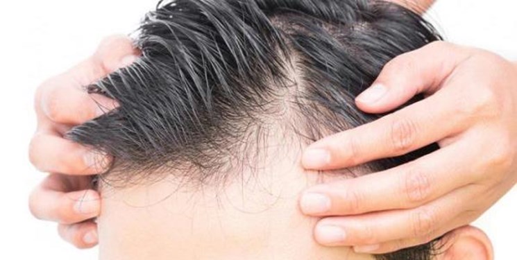 تقویت کننده های طبیعی موی سر را بشناسید